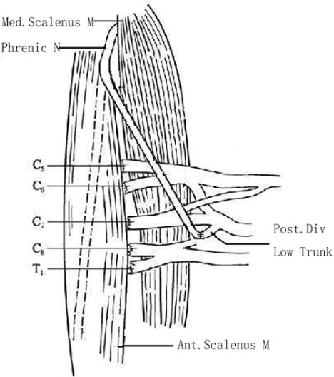 Brachial Plexus Drawing Art