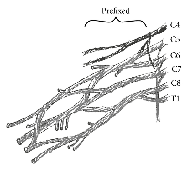 Brachial Plexus Drawing Creative Art