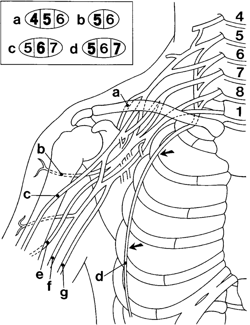 Brachial Plexus Drawing Realistic